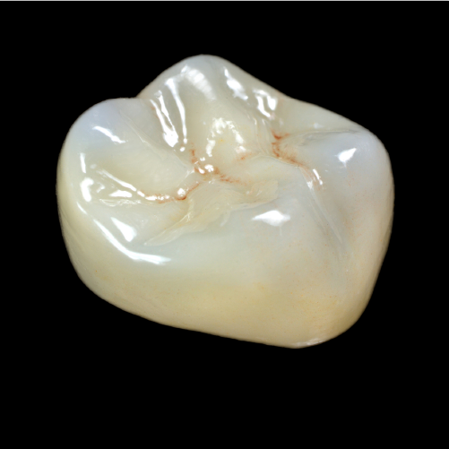 Zirconia Crown Bundle- 10 for $1,399
