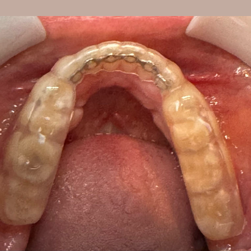 Infiniry & Hercules TMD