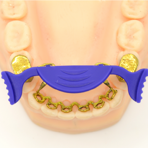 Infinity Serpentine TMO with jig
