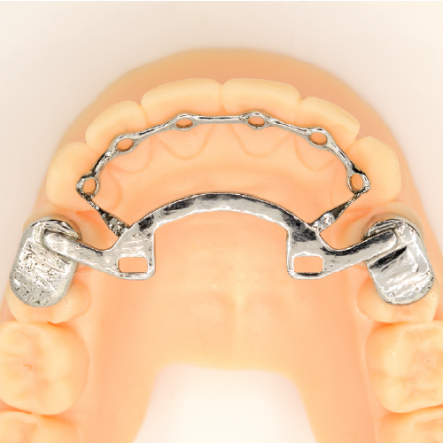 Infinity Fixed Lingual Retainer (Lower)