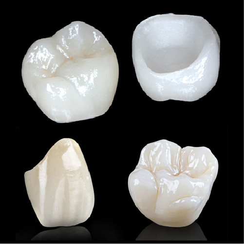 Assorted Crown Bundle - any 30 for $2,999