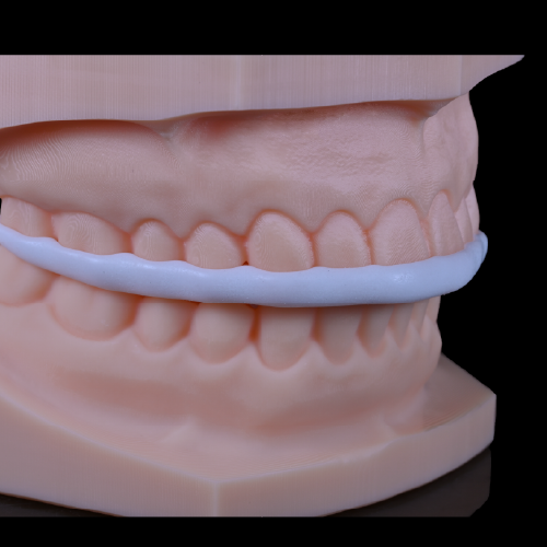 Hard nightguard nylon