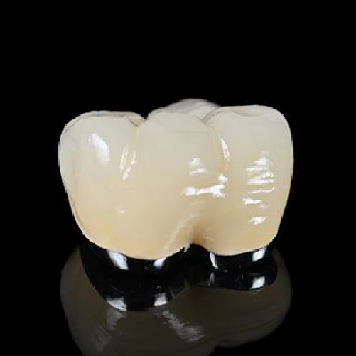 PFM Crown Bundle - 10 for $999